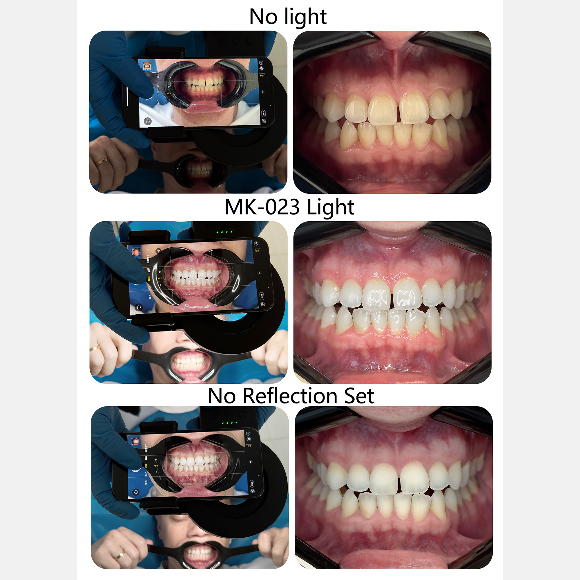 HERA MK-23 Intraoral Dental Ph - Photography Lighting Lamp recensione e prezzo