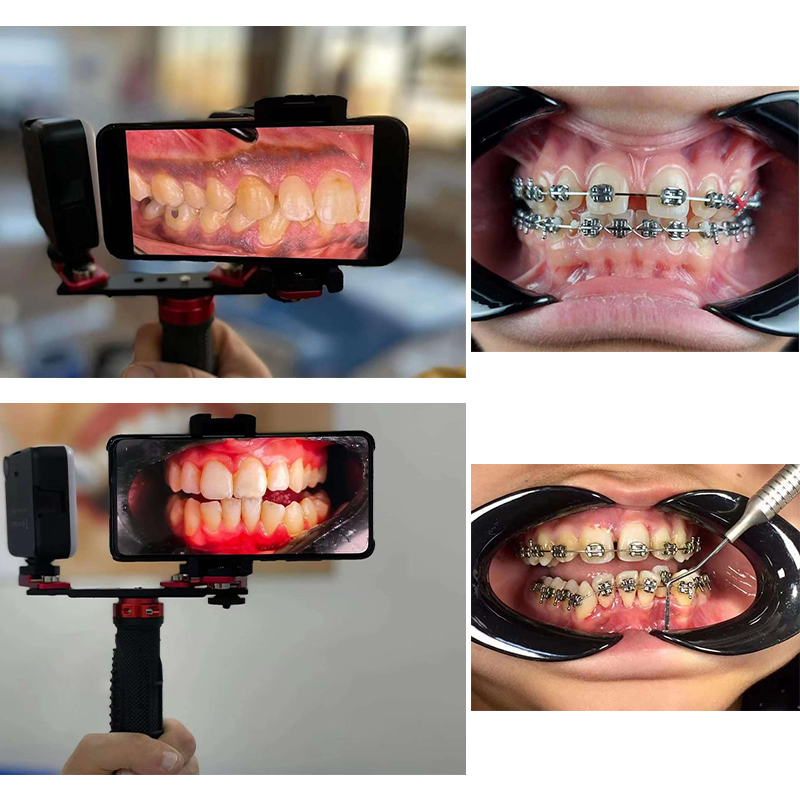Dentistry Material Mobile Phon - Photography Mobile Lighting recensione e prezzo