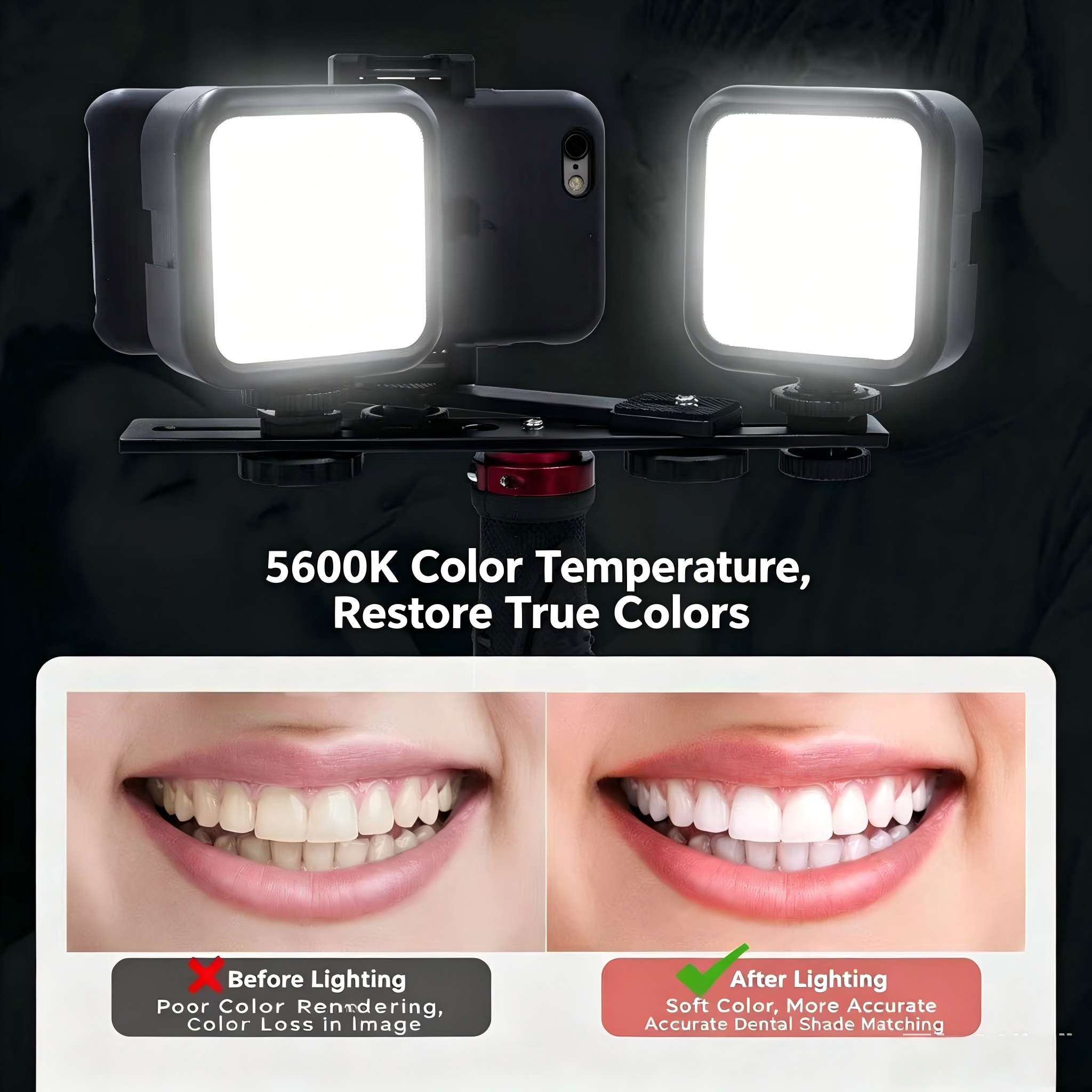 Portable Dental Photography Li - Photography Lighting Basics recensione e prezzo